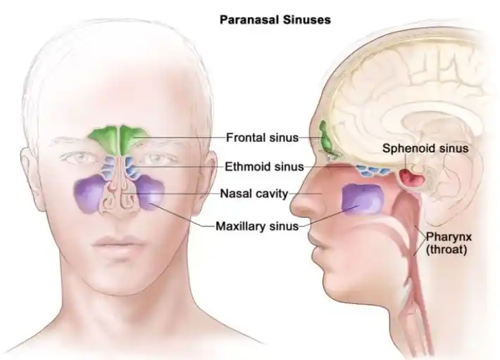 상악동암 , 상악동 Maxillary sinus cancer